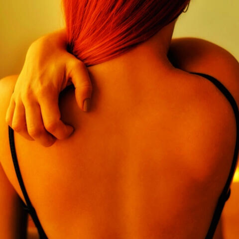 Woman scratching her sunburn, experiencing discomfort as a result of Hell's Itch